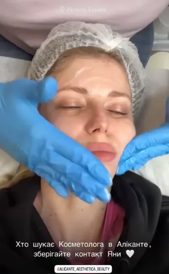 Resultado de una sesión de cosmetología en Aesthetic Spaace, Alicante